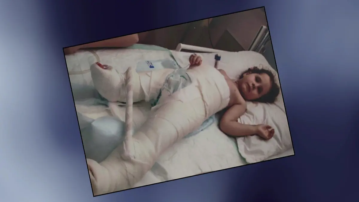 Anna als Kind in Gips fixiert.