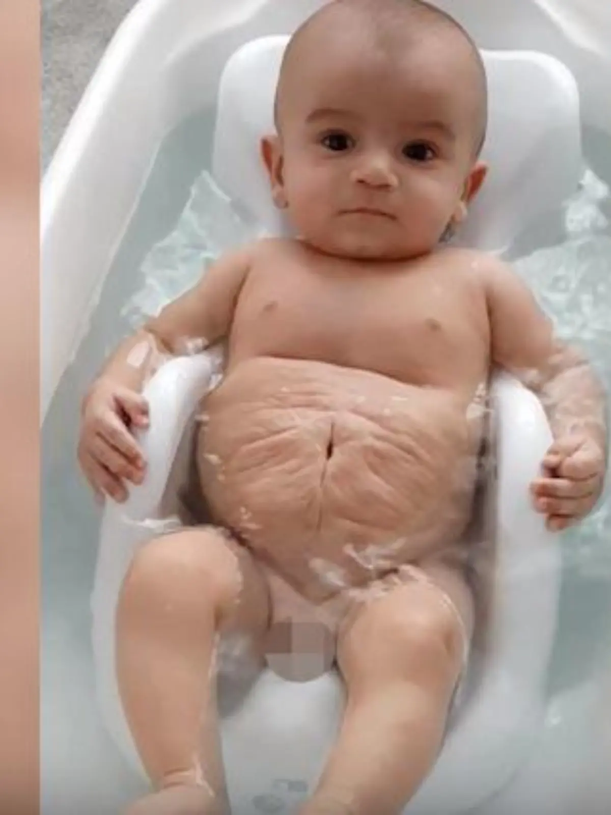 Baby ohne Bauchmuskeln