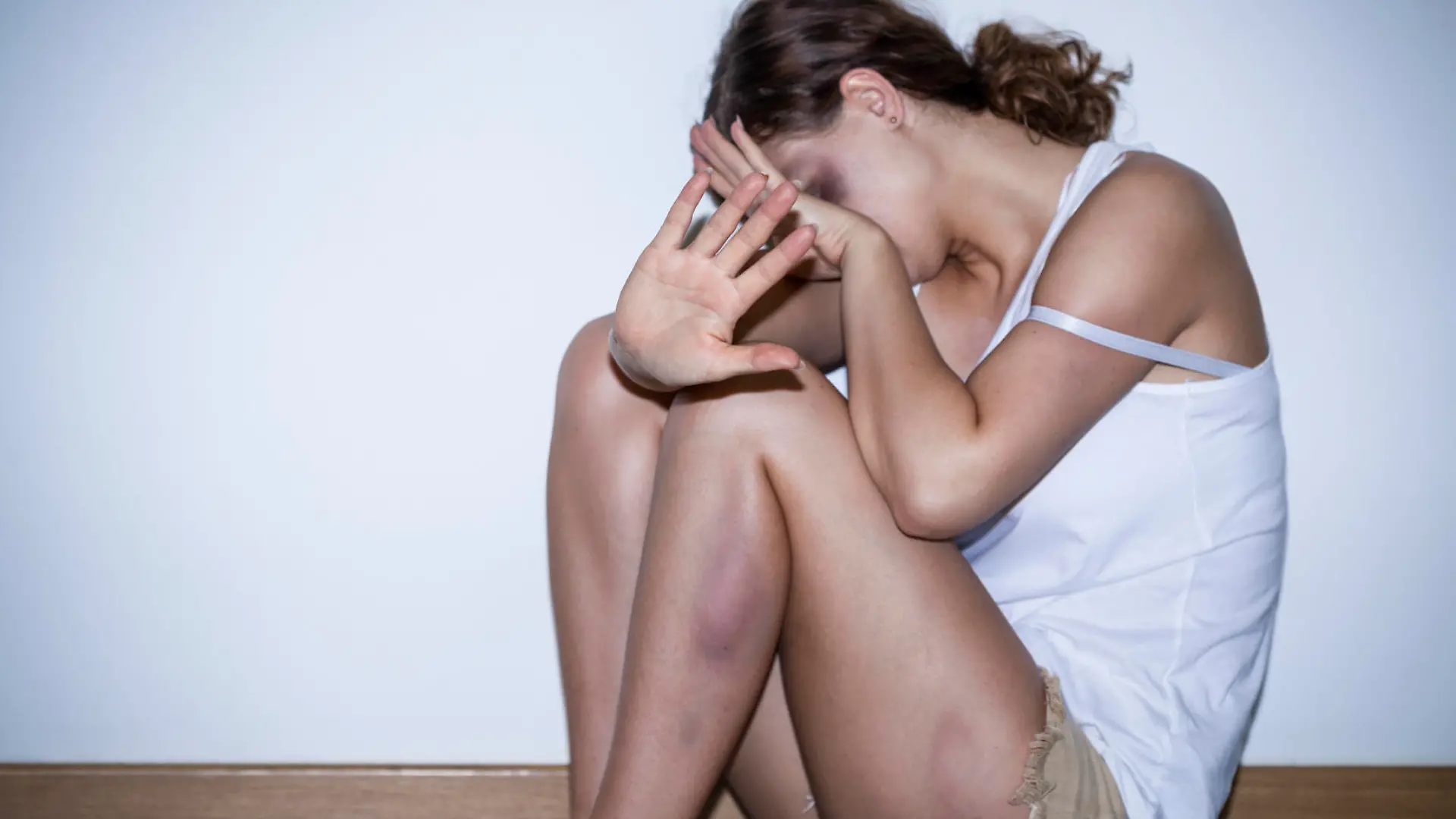 Victim of domestic violence covered with bruises
