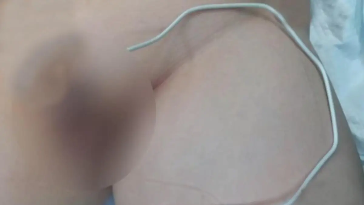 Junge mit Kabel in Penis.