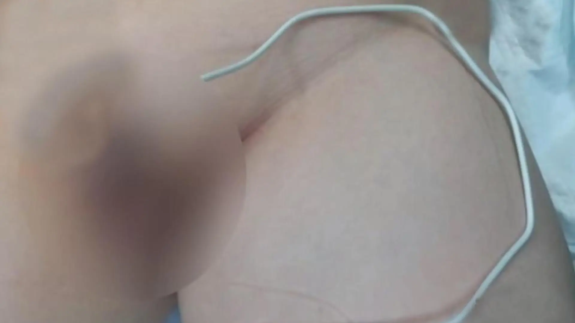 Junge mit Kabel in Penis.