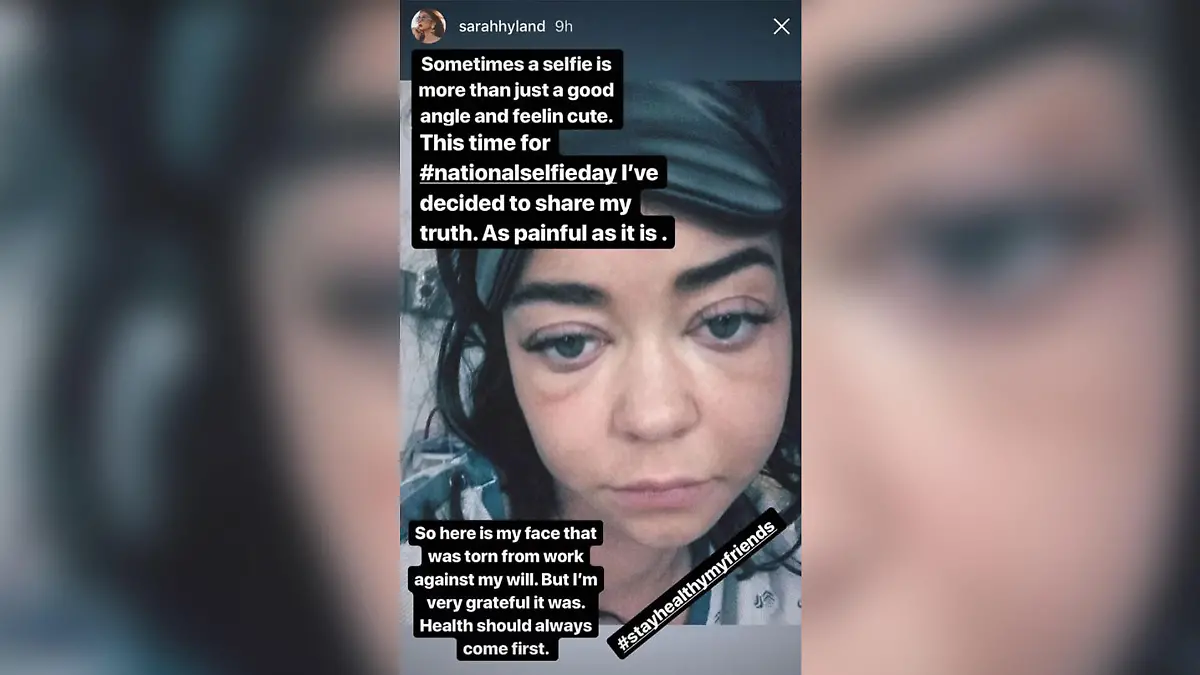 Schockierendes Bild: Sarah Hyland ist kaum wiederzuerkennen