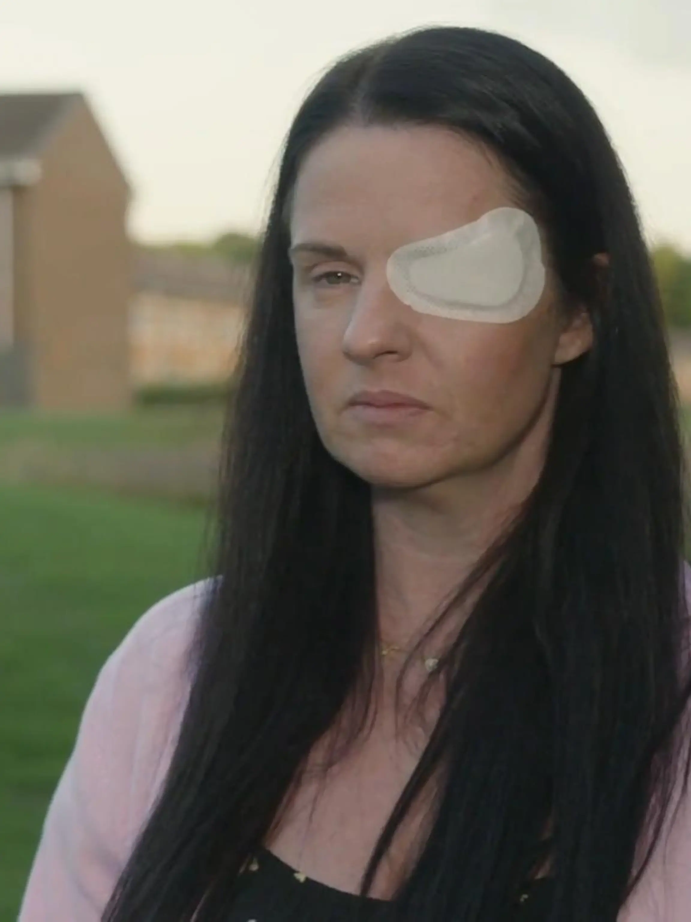 Bild zu: "Fast blind durch Botox! Hailey (36) verliert im Beautywahn fast ihr Leben"