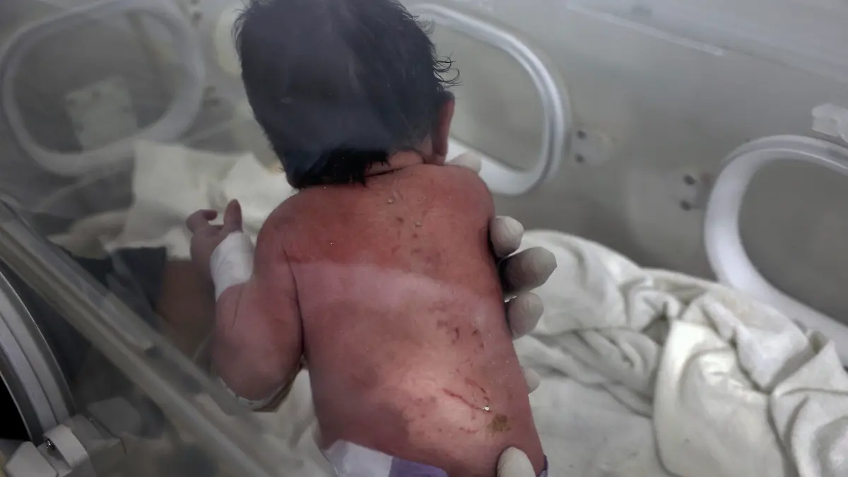 A baby girl who was born under the rubble caused by an earthquake that hit Syria and Turkey receives treatment inside an incubator at a children's hospital in the town of Afrin, Aleppo province, Syria, Tuesday, Feb. 7, 2023.  Residents in the northwest Syrian town discovered the crying infant whose mother gave birth to her while buried underneath the rubble of a five-story apartment building levelled by this week’s devastating earthquake, relatives and a doctor say. (AP Photo/Ghaith Alsayed)