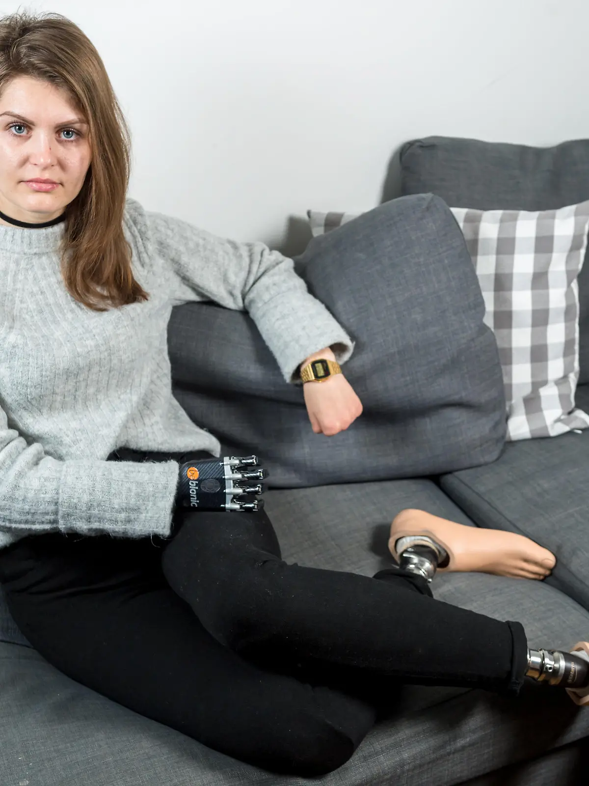 Magdalena Malec muss nun mit Prothesen leben.