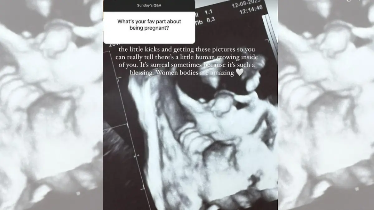 Dieses Ultraschallbild zeigt das ungeborene Baby von Ann-Kathrin Götze.