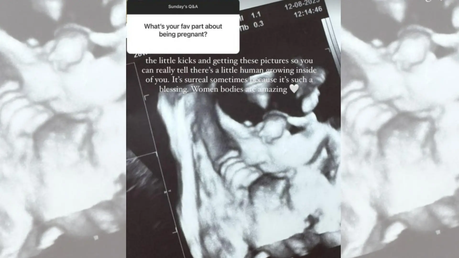 Dieses Ultraschallbild zeigt das ungeborene Baby von Ann-Kathrin Götze.