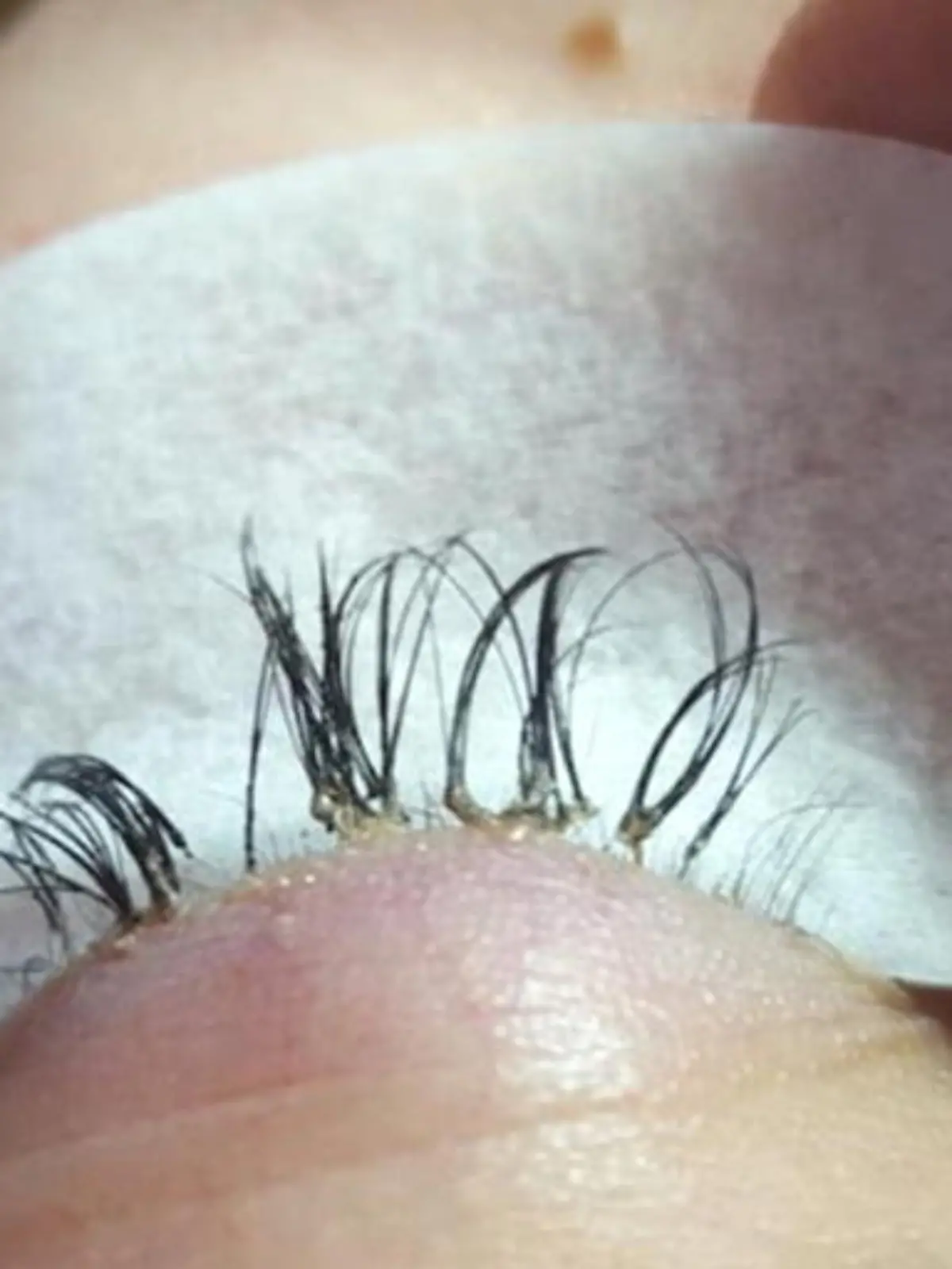 Wimpern ausgefallen