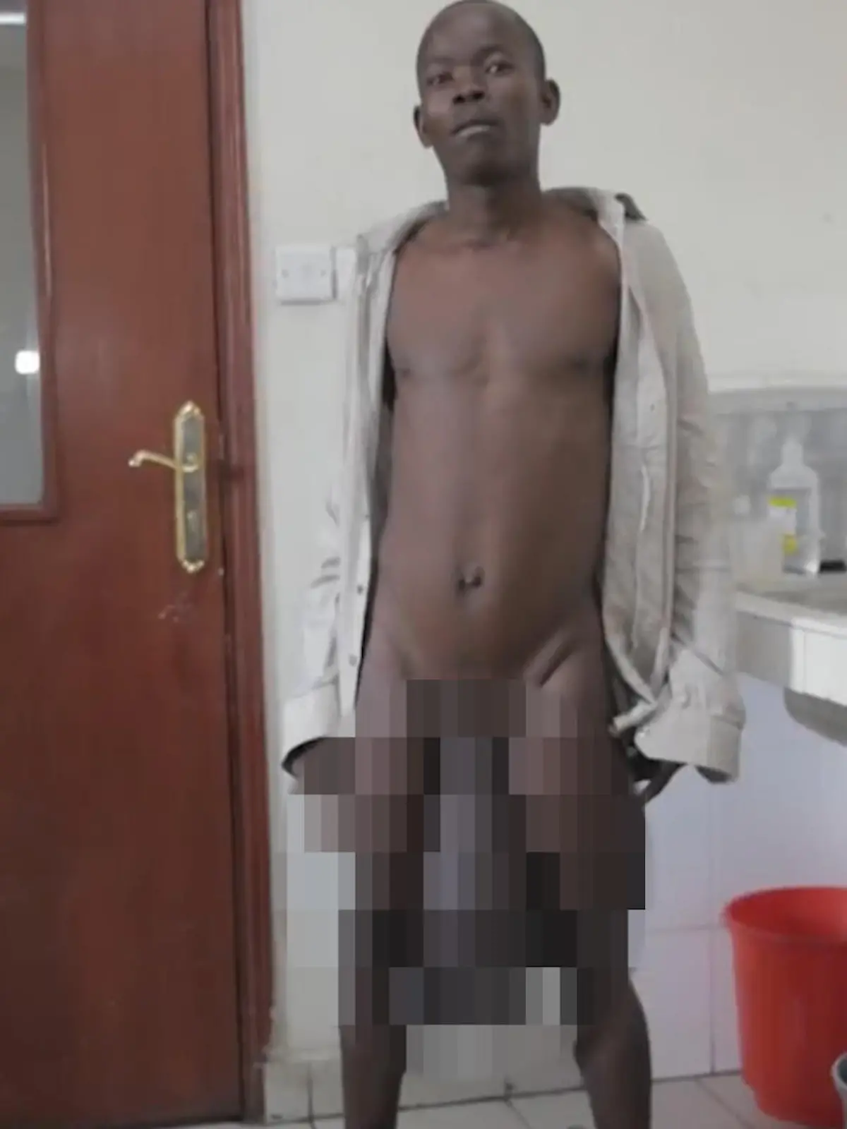 Seine XXL-Genitalien machen Horace Owiti Opiyo das Leben zur Qual