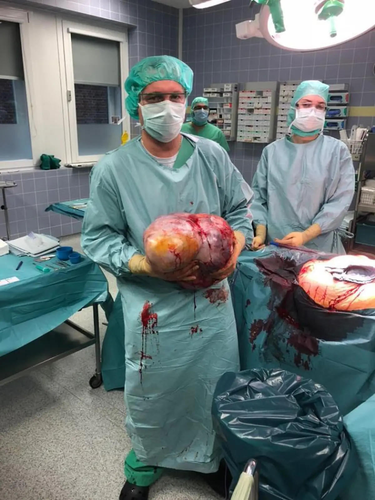 Zehn-Kilo-Tumor