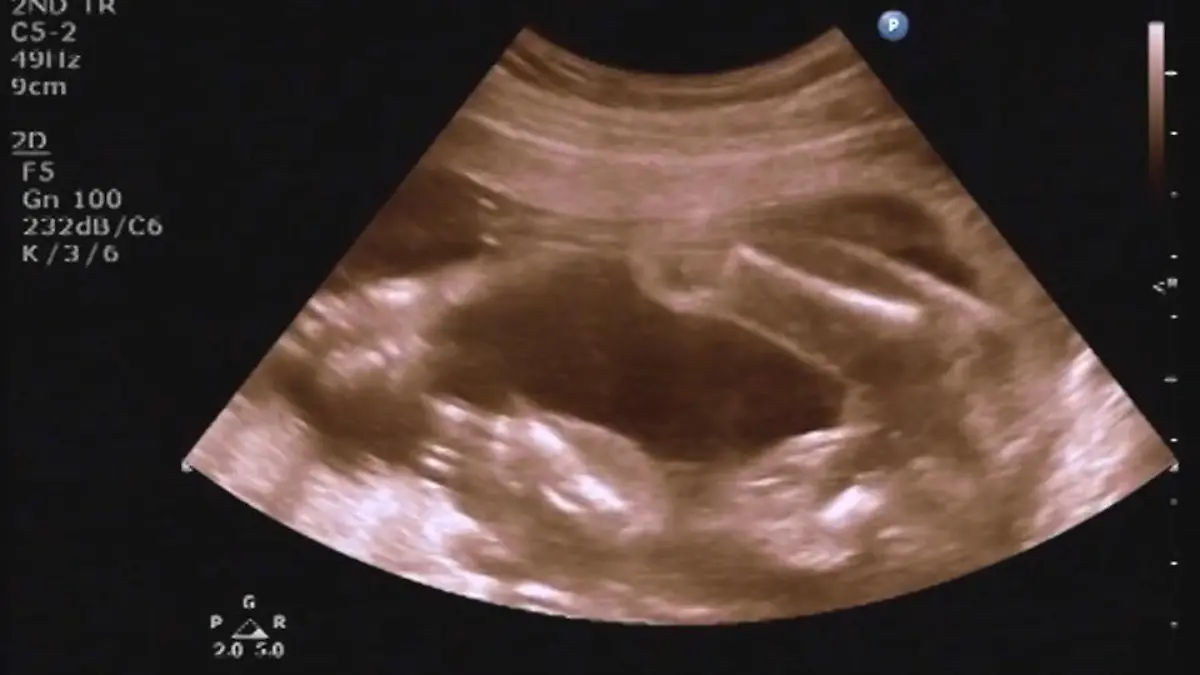 5 faszinierende Dinge, die dein Baby schon im Bauch kann Einfach unglaublich!