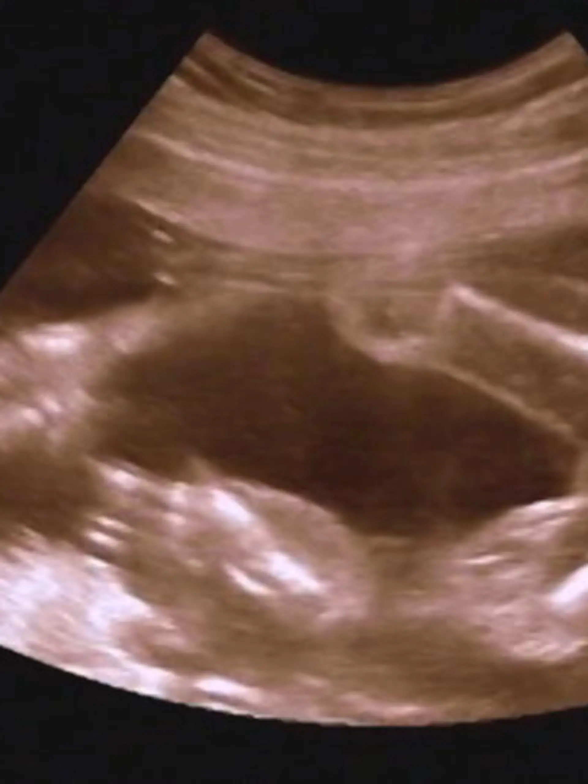 Babys im Bauch liegen mummelig warm gebettet und kriegen so gut wie nichts mit von ihrer Außenwelt? Falsch gedacht! Dein Baby kann im Bauch bereits mehr als du denkst. Welche Fähigkeiten das sind, erfährst du im Video.