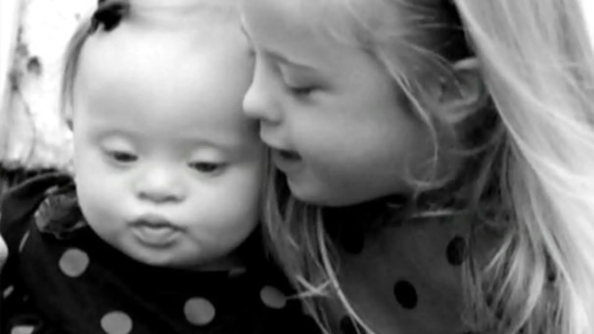 kinder mit down-syndrom