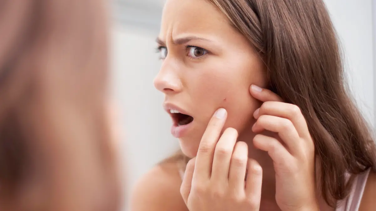 7 Ursachen für unreine Haut ab 30 Pickelchen und Mitesser