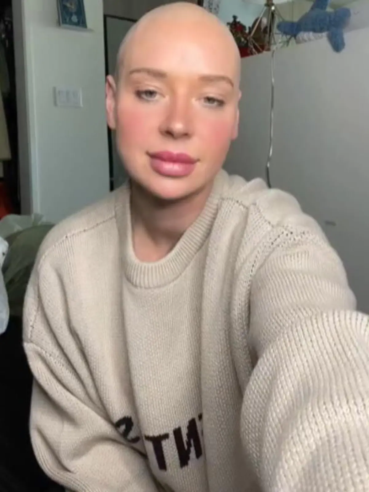 Allie McLaren ist jung, gutaussehend und hat ihren Traum wahrgemacht, als Schauspielerin in Los Angeles zu leben. Trotzdem behauptet sie auf ihrem Tiktok-Kanal, dass sie der größte Pechvogel der Welt sei. Um diese Aussage zu verstehen, muss man etwas zurück in die Vergangenheit reisen. Seit Ende 2021 verfolgt Allie nämlich eine Pechsträhne, die einen Kieferbruch, einen Hirntumor und einen Verkehrsunfall mit sich gezogen hat.