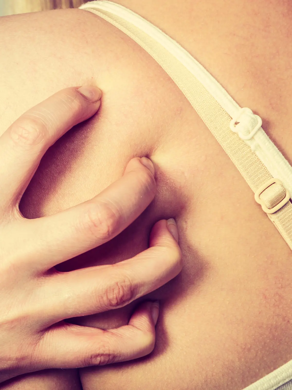 Health problem, skin diseases. Young woman scratching her itchy back with allergy rash