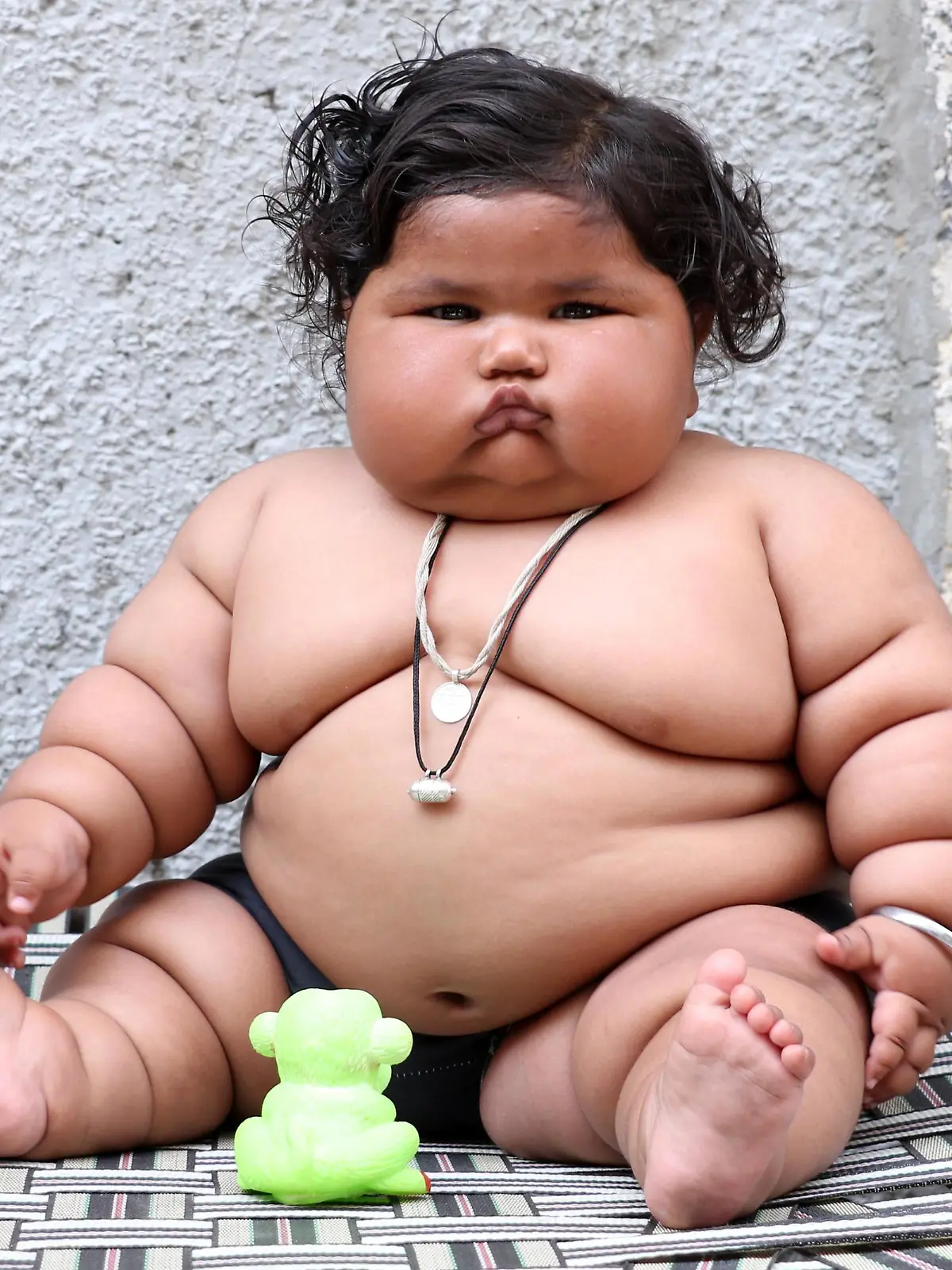 Chahat Kumar ist vermutlich das dickste Baby der Welt. Sie guckt traurig, kann sich kaum bewegen.
