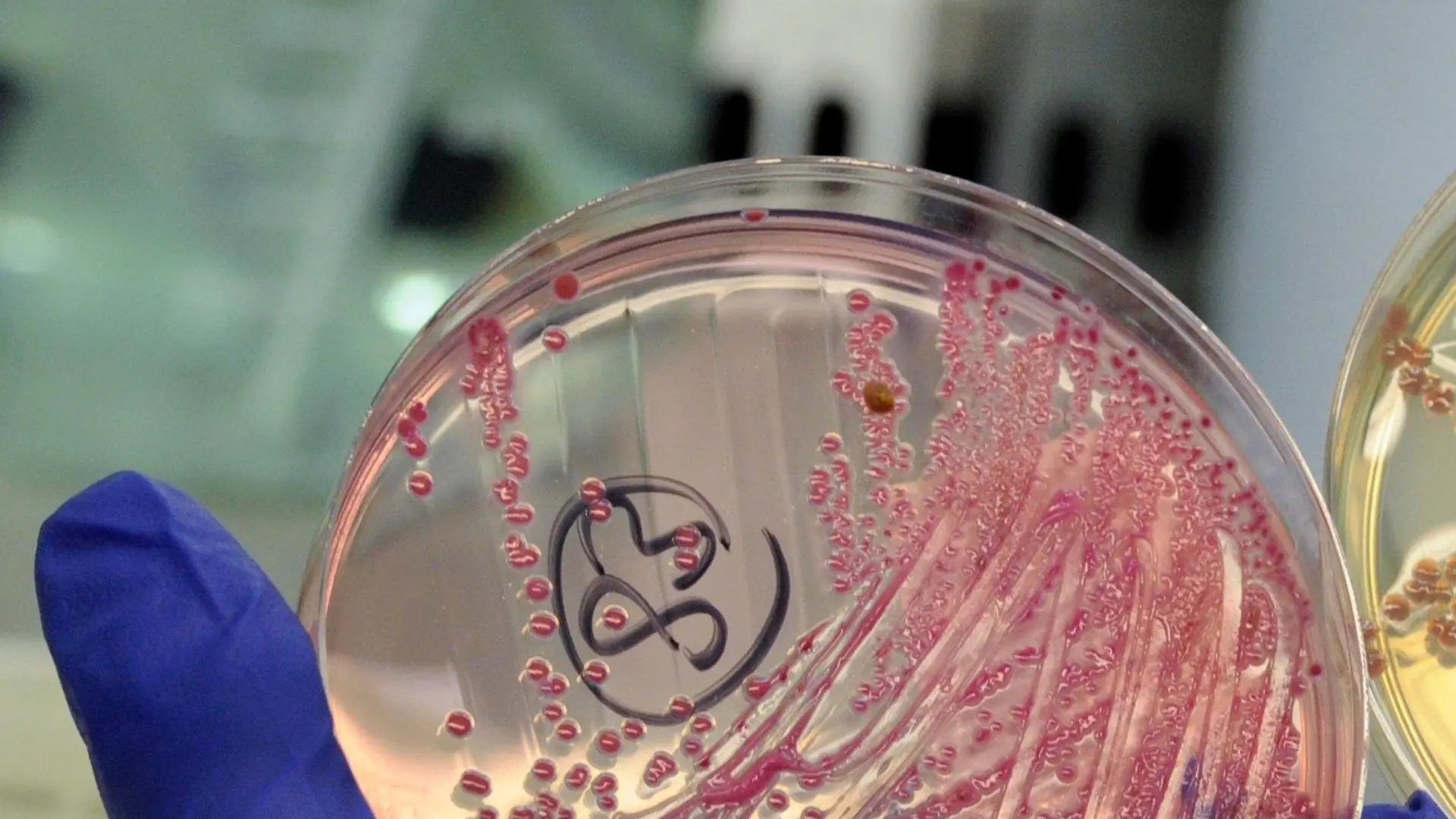 An employee holds petri dishes with bacterial strains of EHEC bacteria (bacterium Escherichia coli.) in the microbiological laboratory of the 'Universitaetsklinikum Hamburg-Eppendorf ' (University Clinic Eppendorf- UKE) in the northern German town of Hamburg, June 2, 2011. REUTERS/Fabian Bimmer (GERMANY - Tags: HEALTH SCI TECH)