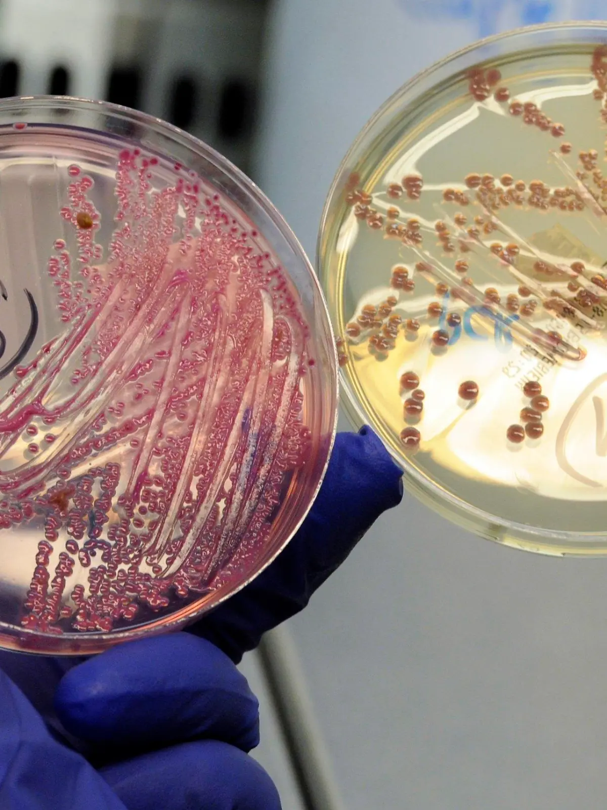 An employee holds petri dishes with bacterial strains of EHEC bacteria (bacterium Escherichia coli.) in the microbiological laboratory of the 'Universitaetsklinikum Hamburg-Eppendorf ' (University Clinic Eppendorf- UKE) in the northern German town of Hamburg, June 2, 2011.     REUTERS/Fabian Bimmer (GERMANY - Tags: HEALTH SCI TECH)