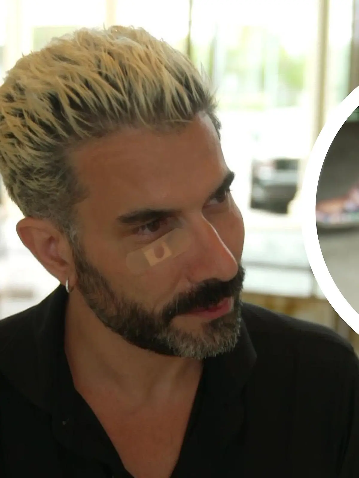 Verena Kerth und Marc Terenzi mit Verletzungen im Gesicht.