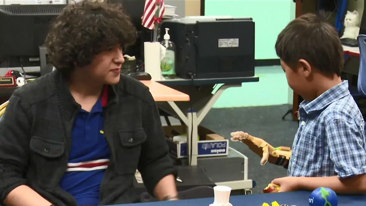 Zack (6) kann zum ersten Mal jemandem die Hand geben Handprothese aus dem 3D-Drucker