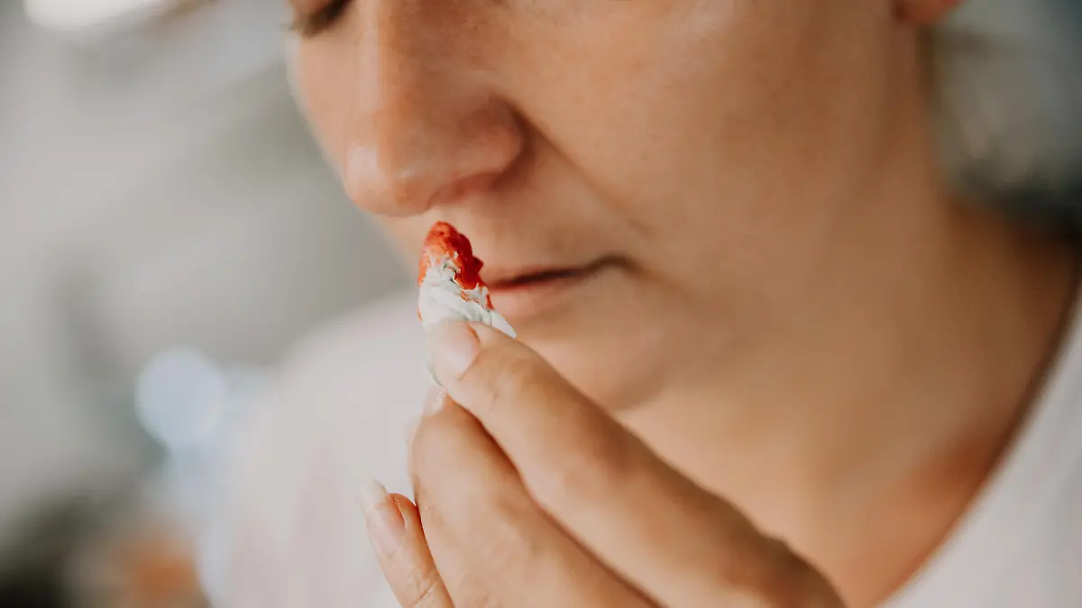 Woman wiping her bleeding nose with tissue