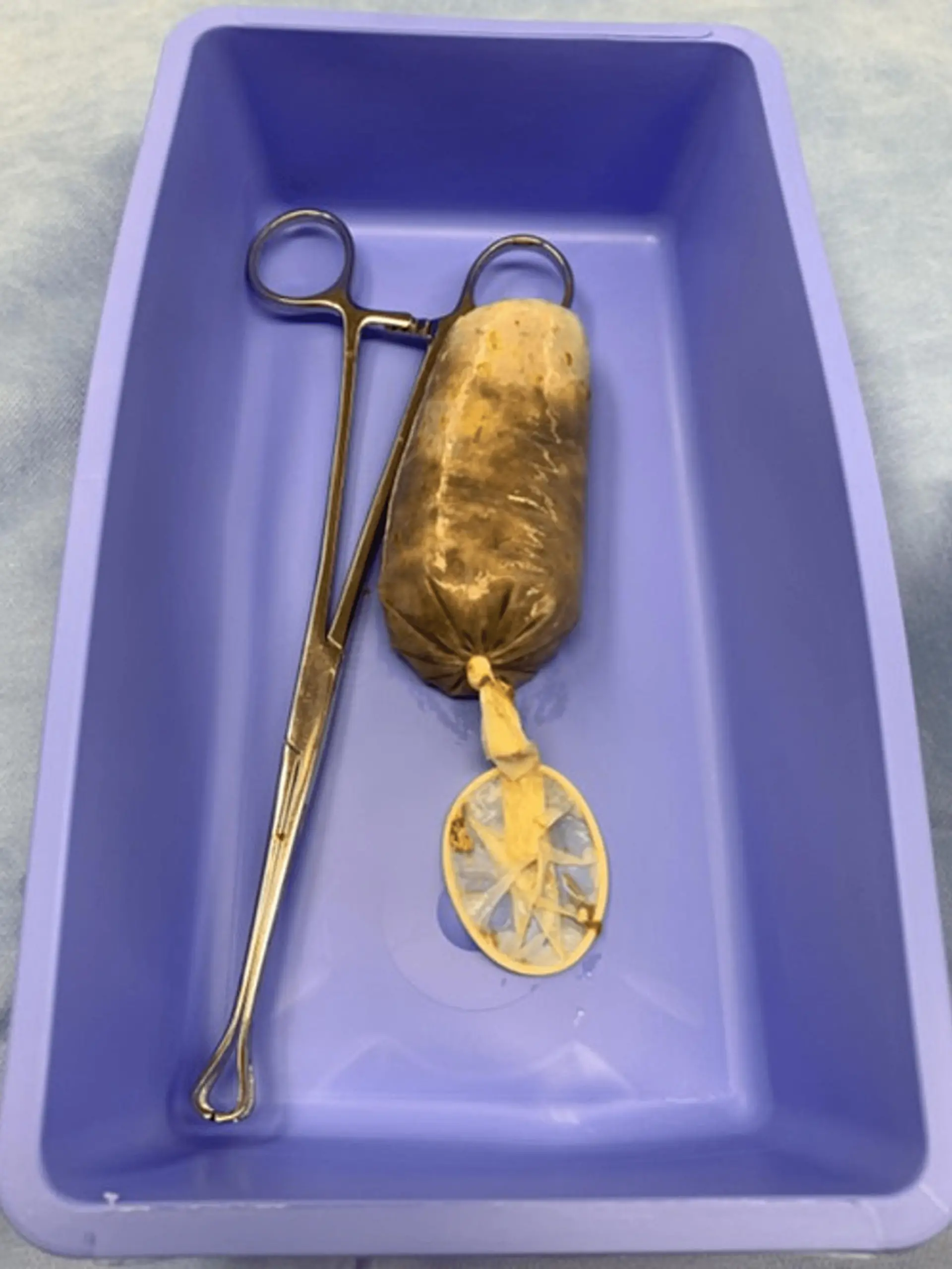 Story from Jam Press (Banana Condom Swallowed)

Pictured: The now removed banana-stuffed condom.

Man taken to hospital after eating a banana in a condom

A man was rushed to hospital after swallowing a banana in a CONDOM.

The unnamed victim had gulped the fruity contraceptive whole during a fit of rage.

The 34-year-old began vomiting and complained of stomach pains when he was rushed to hospital last year.

Doctors performed a CT scan where they found the slippery fruit lodged in his small intestine.

He had been unable to go to the loo for 24 hours as the fruit had been blocking his bowel.

The man was then rushed to surgery where doctors safely removed the banana.

Photos show the brown mushy filled condom beside the surgical scissors used to fish it out.

The man rested in hospital for three days before he was discharged.

It is believed to be the first case of an individual swallowing a banana in a condom.

This appeared in the Cureus Journal of Medical Science by radiologists Rosarie Tudas, Karan Rao, Yashant Aswani and surgeon Luis J. Garcia from the University of Iowa.

ENDS