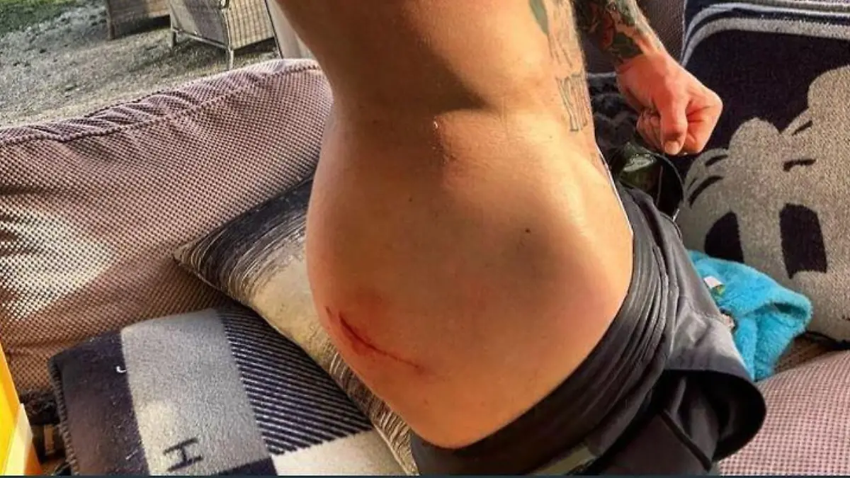 Conor McGregor hatte einen Unfall mit dem Fahrrad