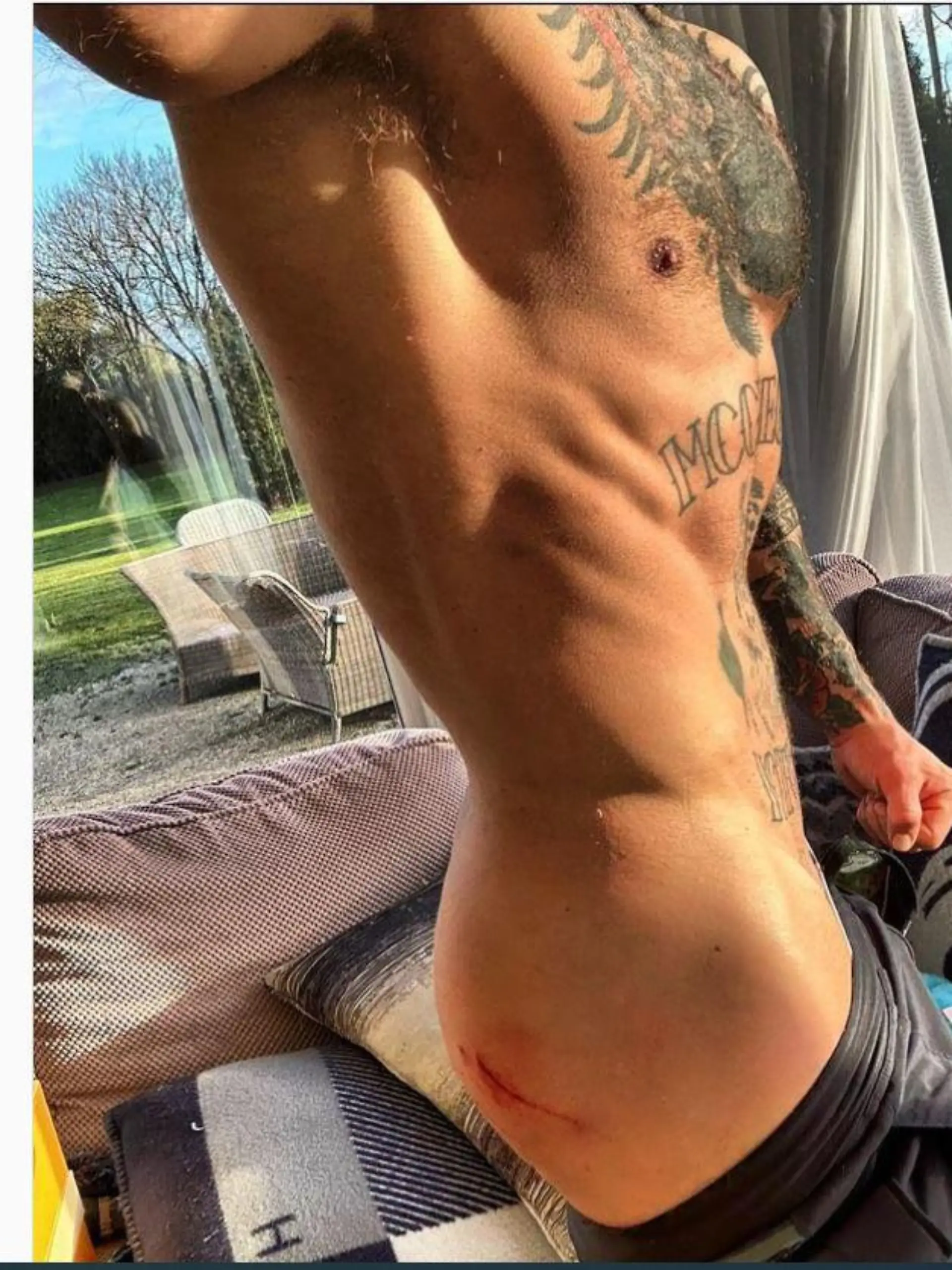 Conor McGregor hatte einen Unfall mit dem Fahrrad
