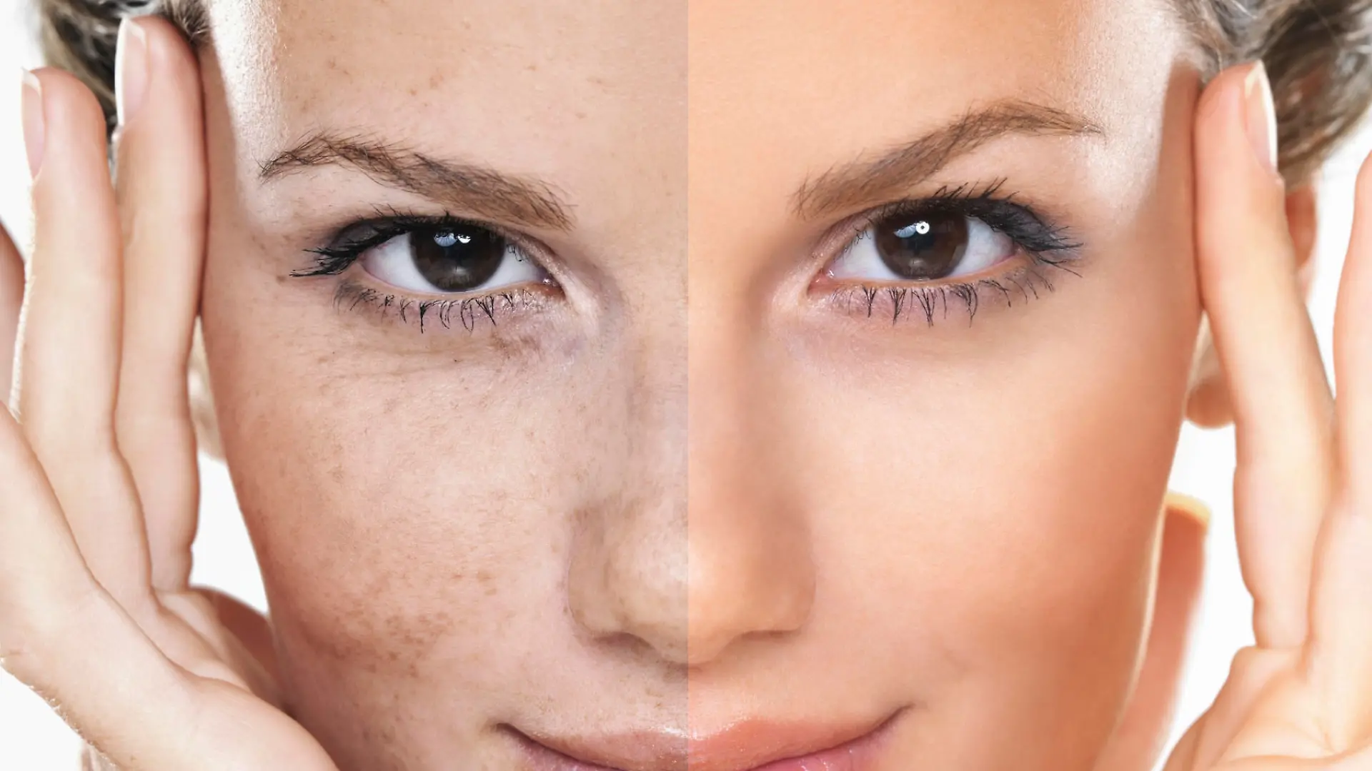 Closeup conceptual portrait of pretty woman with her face divided into two skin types