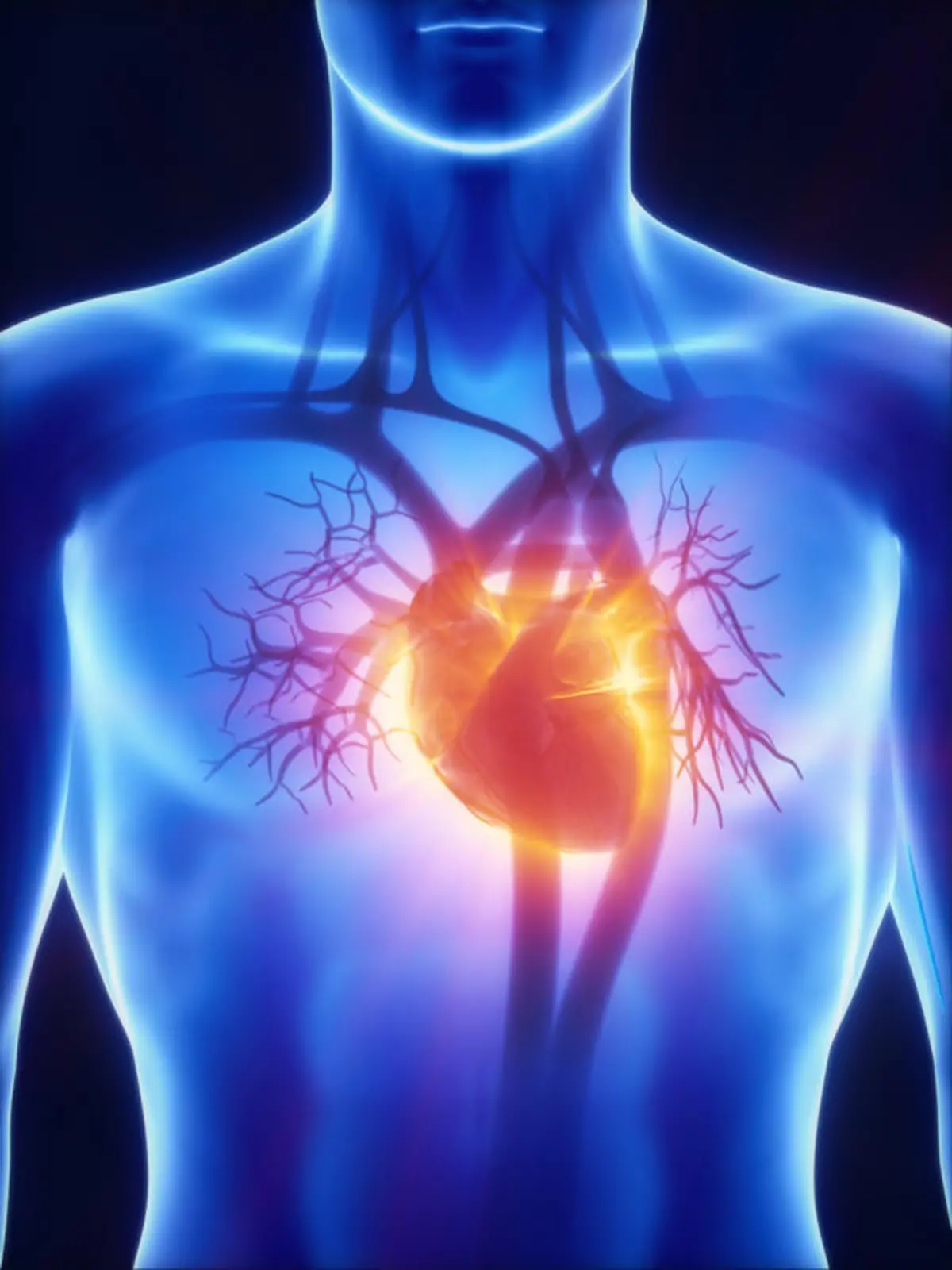 X-ray cardiovascular system Herzinfarkt Herz Herz-Kreislauf