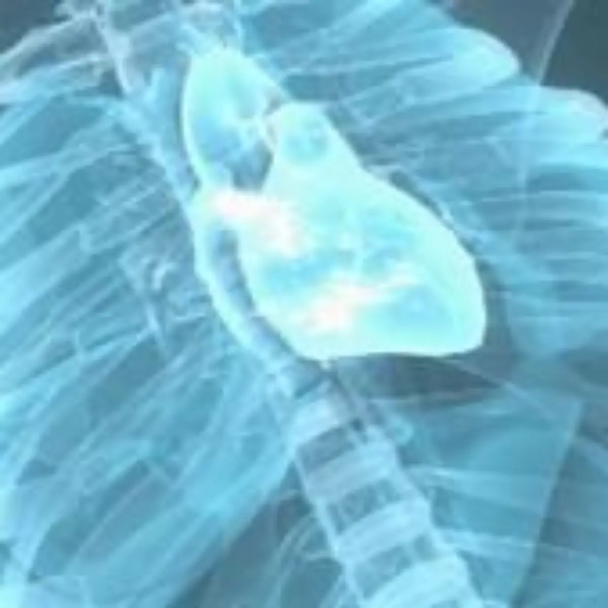 Herzinsuffizienz Logo von Herzinsuffizienz