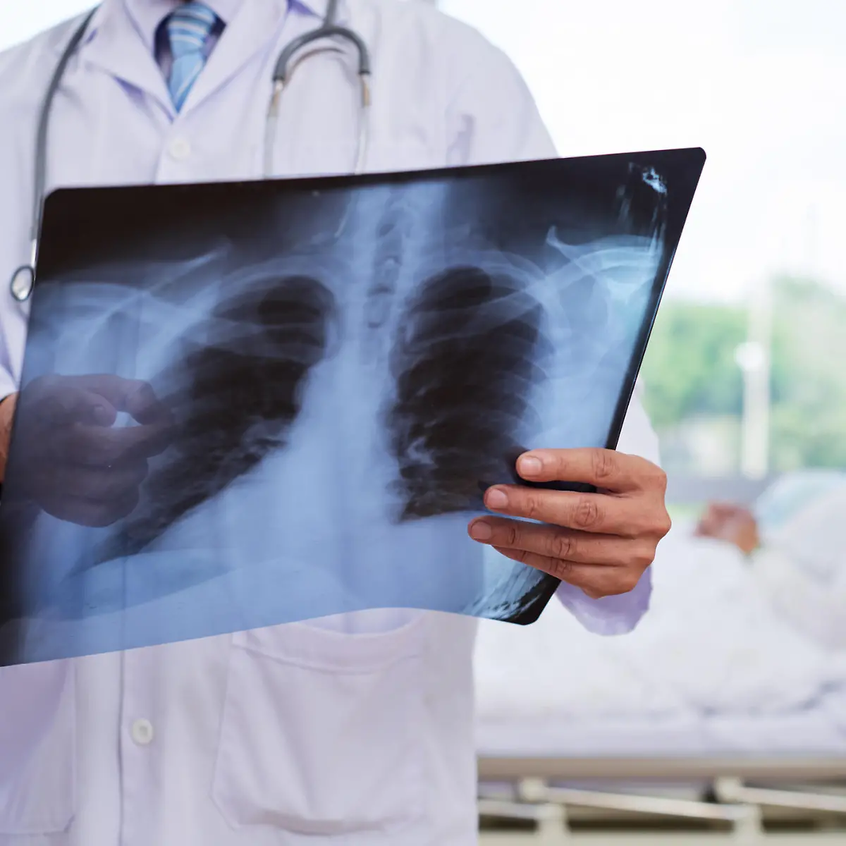 Lungenentzündung (Pneumonie) Logo von Lungenentzündung (Pneumonie)