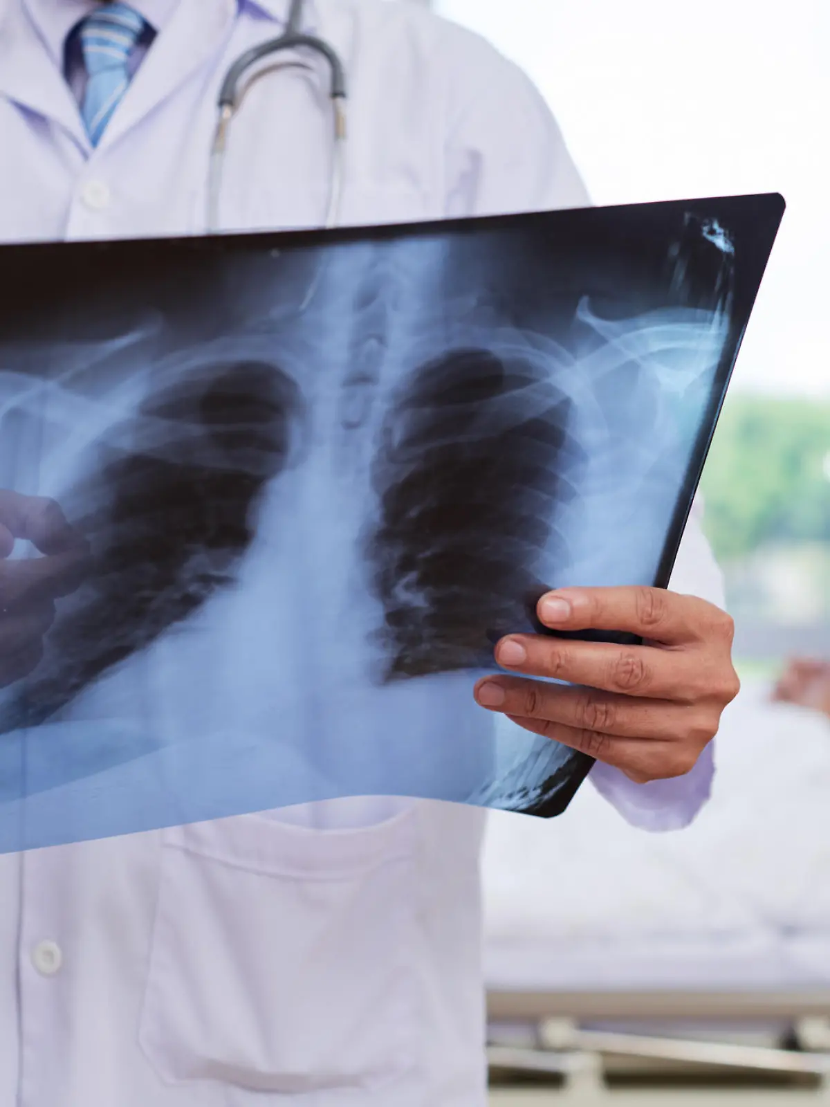 Chest x-ray in hands of medical worker