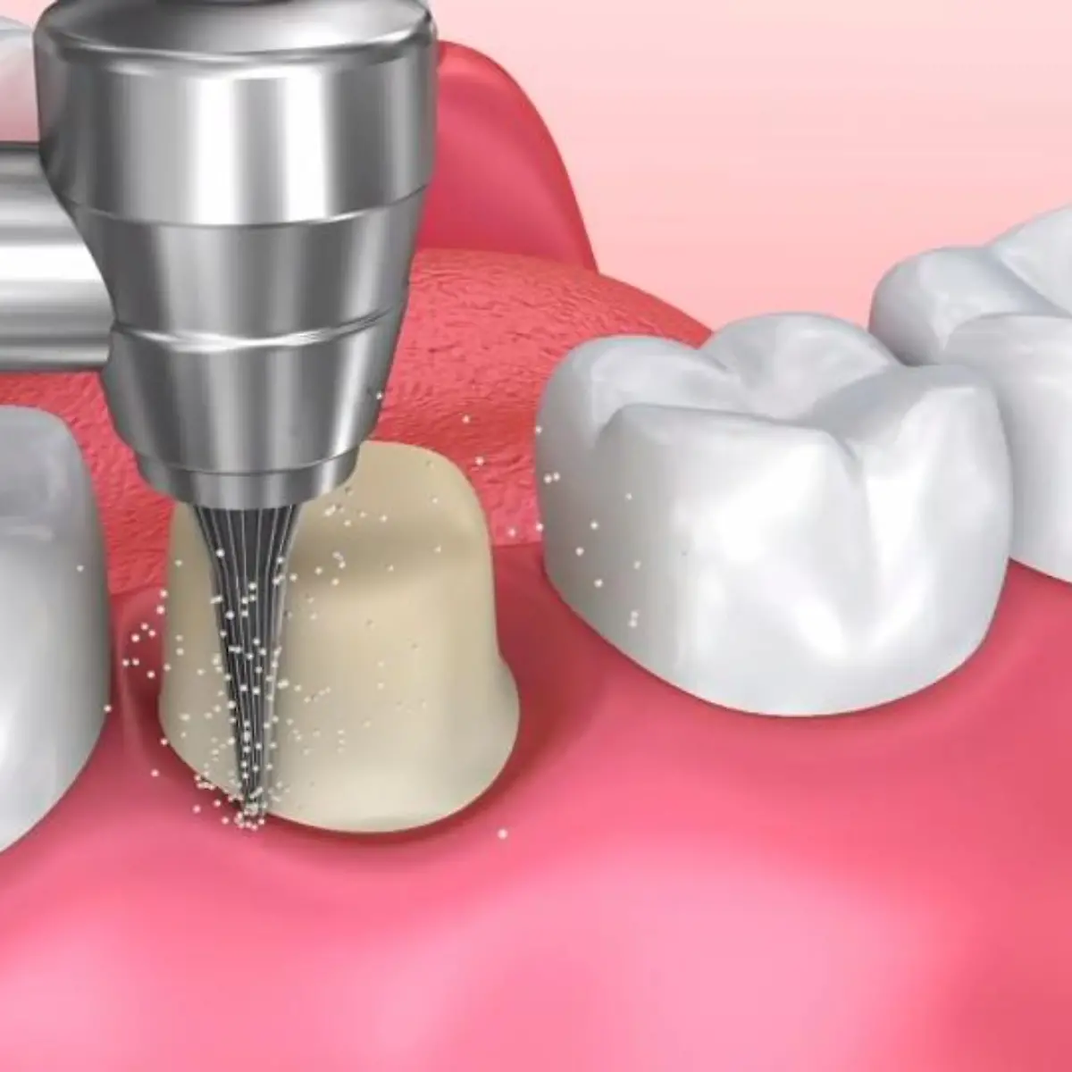 Zahnkrone Logo von Zahnkrone