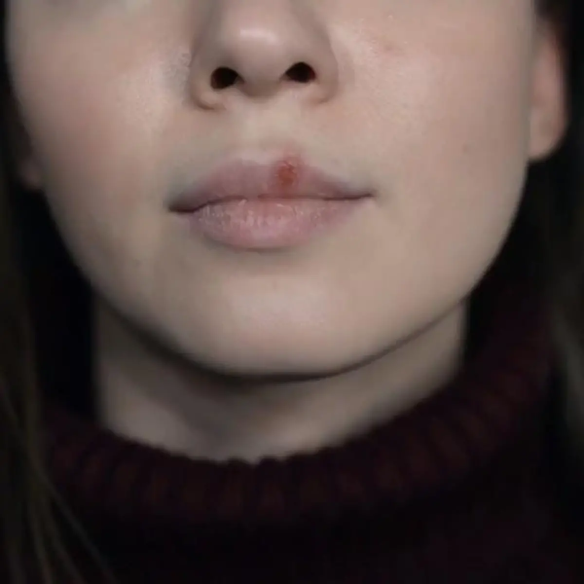 Herpes Logo von Herpes