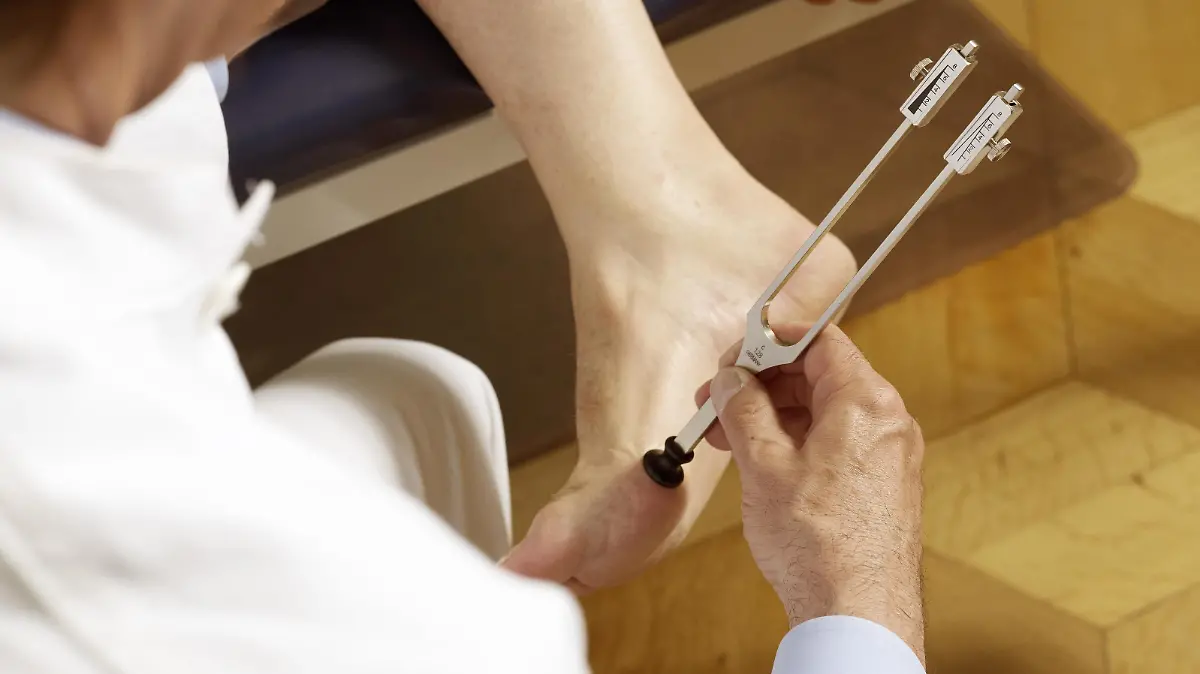 Stimmgabeltest am Fuß eines Patienten bei Verdacht auf diabetische Polyneuropathie | Verwendung weltweit, Keine Weitergabe an Wiederverkäufer.