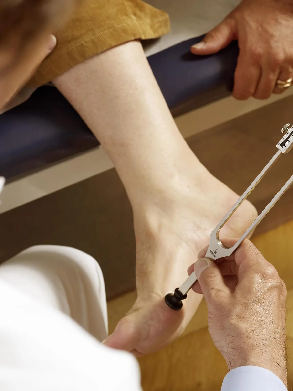 Stimmgabeltest am Fuß eines Patienten bei Verdacht auf diabetische Polyneuropathie | Verwendung weltweit, Keine Weitergabe an Wiederverkäufer.