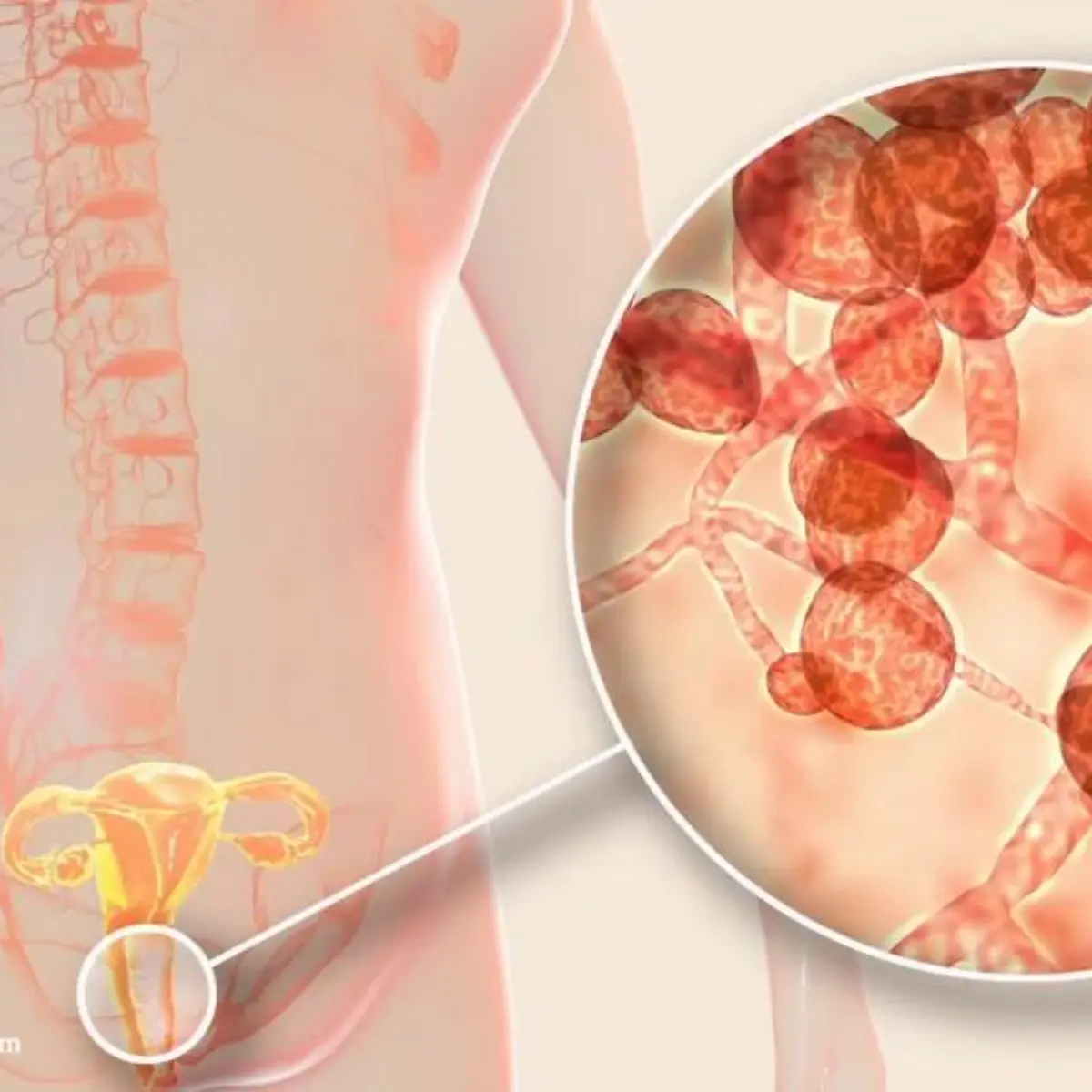 Scheidenpilz (Vaginalpilz) Logo von Scheidenpilz (Vaginalpilz)