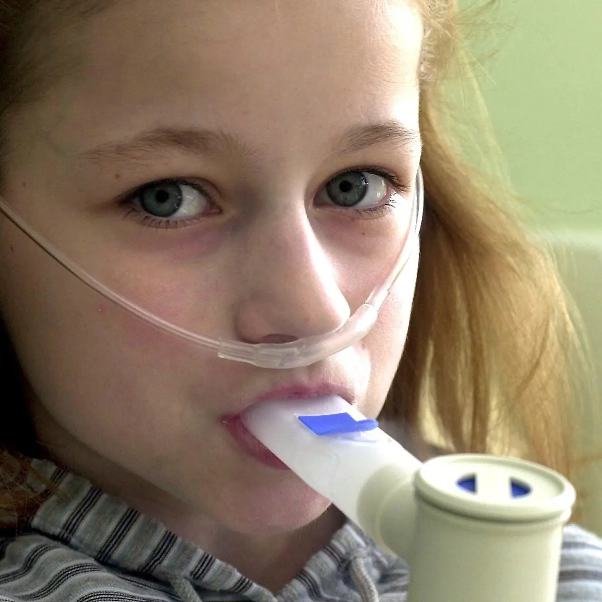 Mukoviszidose (zystische Fibrose) Logo von Mukoviszidose (zystische Fibrose)