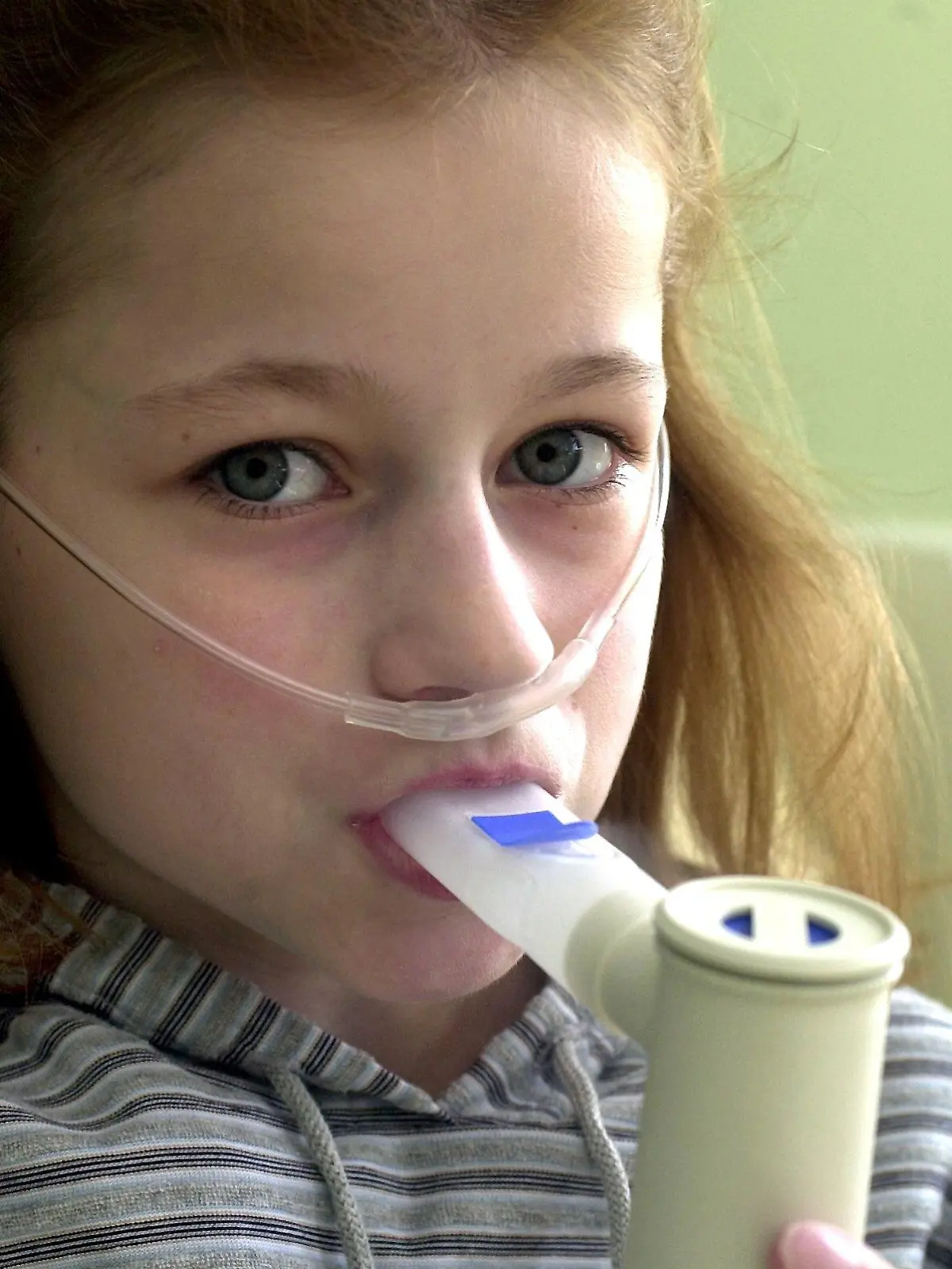 Mit Kochsalz versetzte Dämpfe inhaliert die schwer an Mukoviszidose erkrankte Selina Eckardt (12) am 24.8.2000 in der Jenaer Ambulanz für Mukoviszidose der Universitäts-Kinderklinik. An der größten Gesundheitseinrichtung ihrer Art in Thüringen werden derzeit 46 an Mukoviszidose erkrankte Patienten behandelt. Bei den Betroffenen werden Atemwege und Bauchspeicheldrüse durch Schleim verstopft. Noch vor 20 Jahren verstarben die meisten Patienten schon im Vorschulalter. Durch medizinische Fortschritte kann heute jeder zweite Erkrankte 30 Jahre und älter werden.