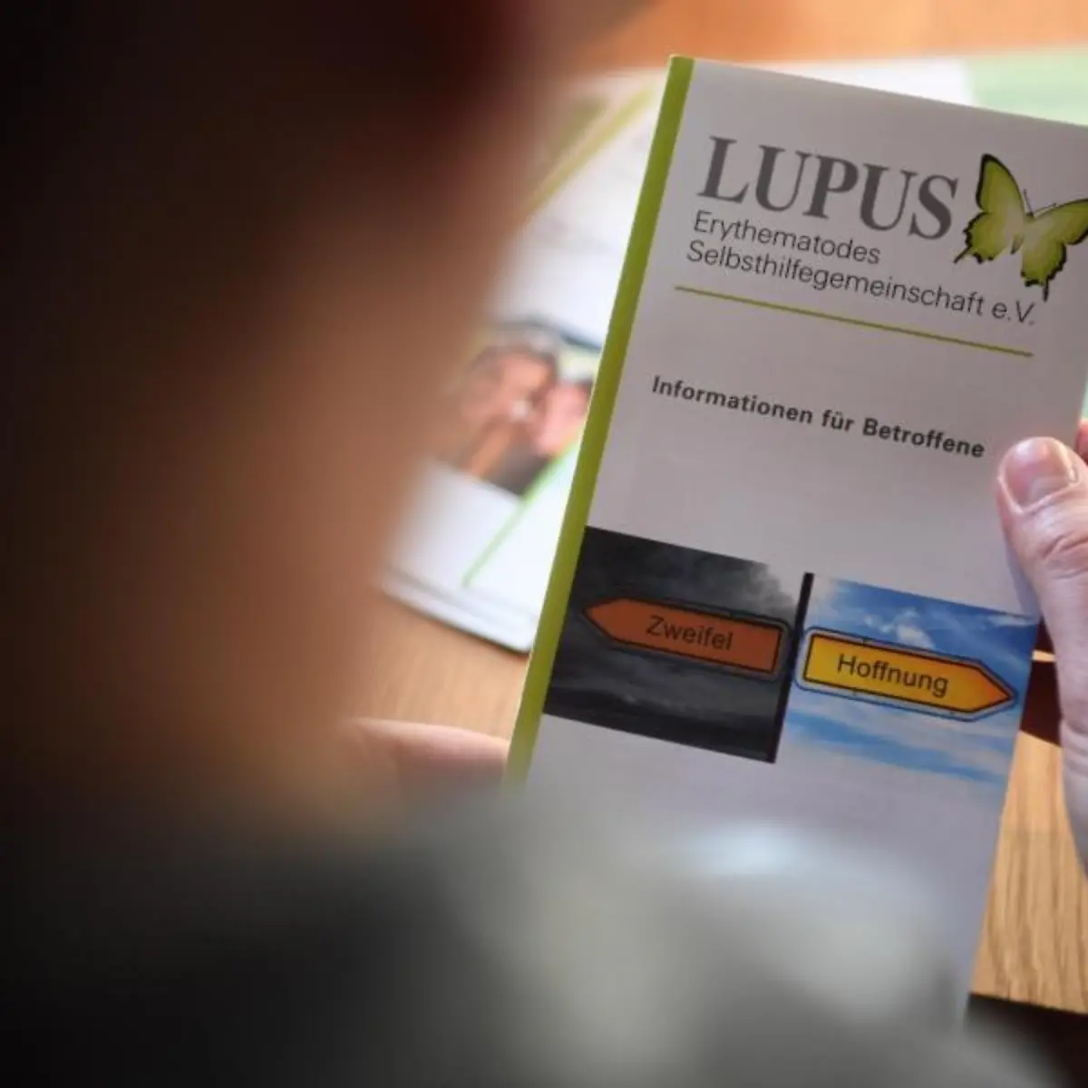 Lupus (Lupus erythematodes) Logo von Lupus (Lupus erythematodes)