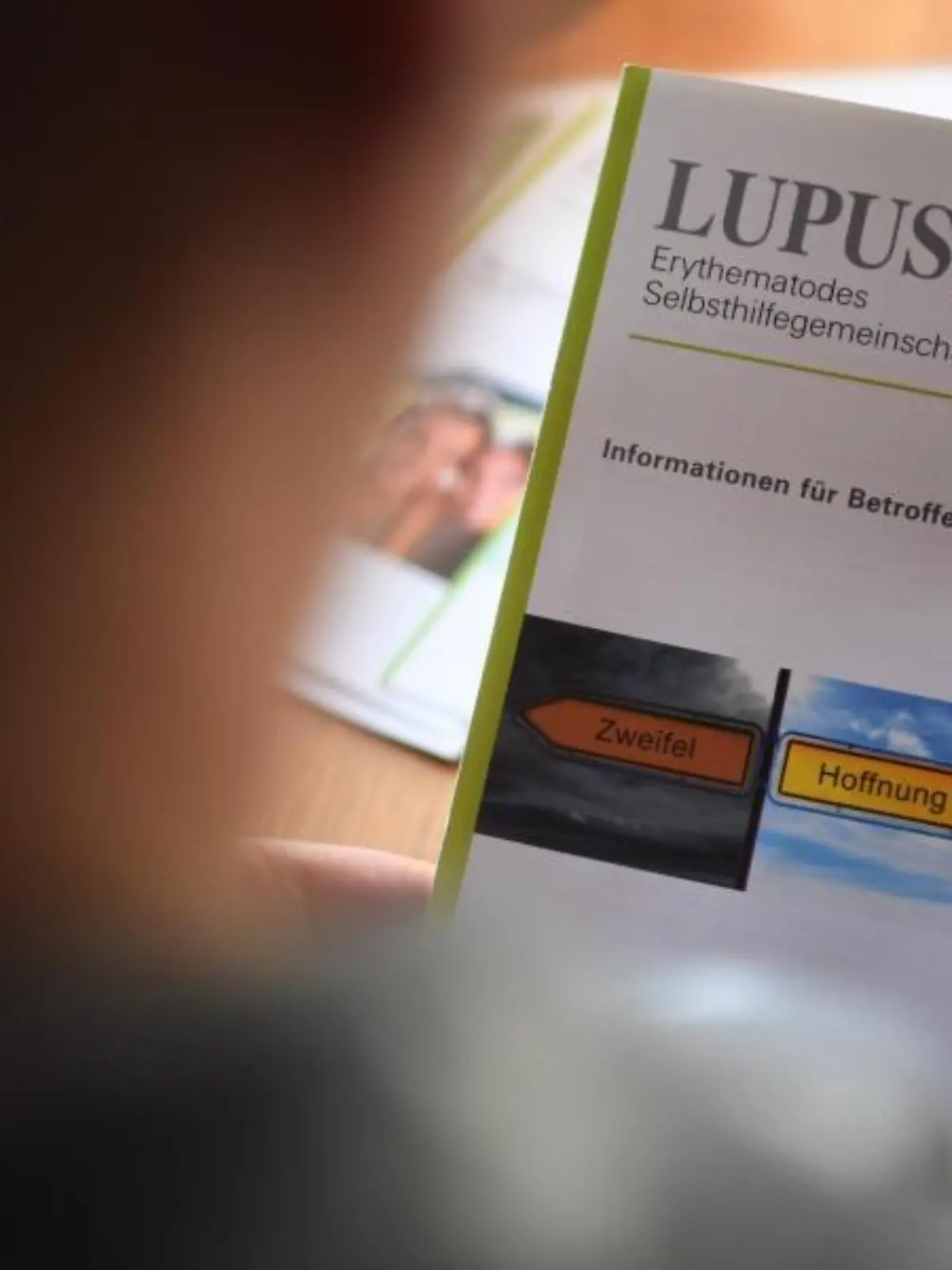 Krankheit Lupus