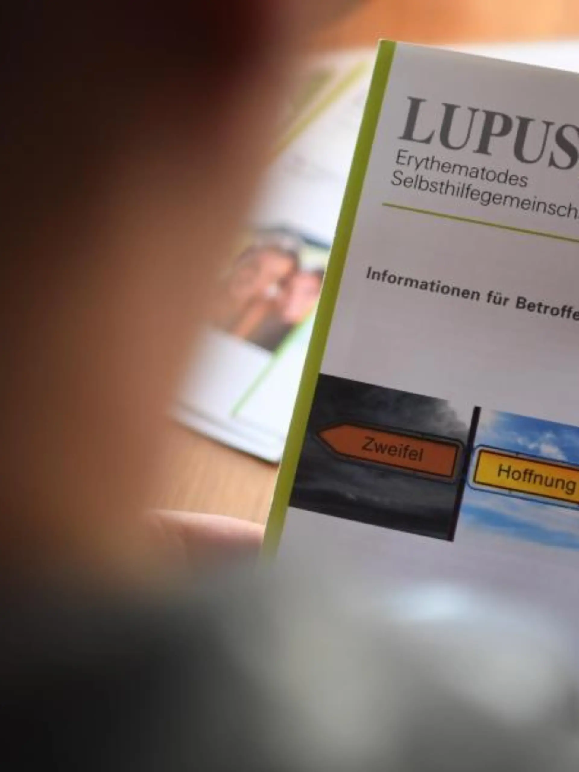 Krankheit Lupus