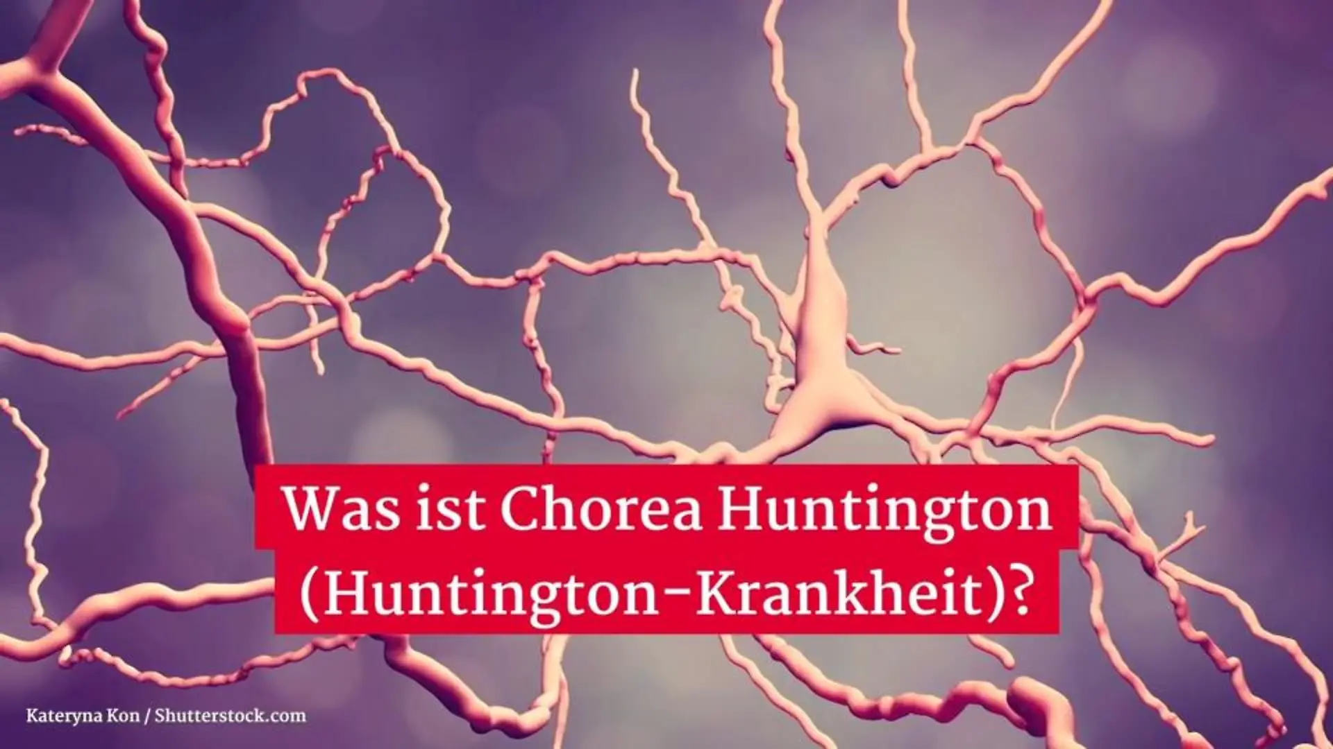 Was ist Chorea Huntington? Gesundheitslexikon