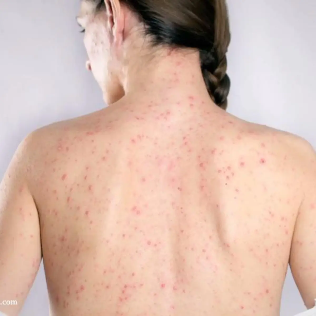 Röteln Logo von Röteln