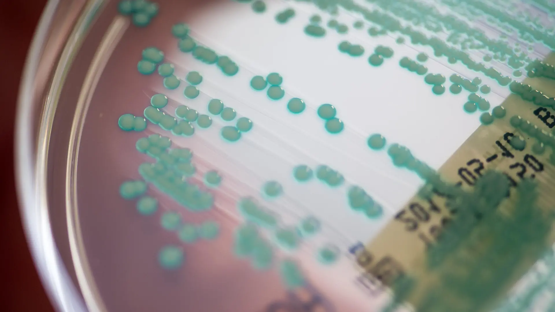 Eine Petrischale mit MRSA-Keimen (Methicillin-resistenten Staphylococcus aureus), aufgenommen am 10.04.2017 im Universitätsklinikum Regensburg (Bayern). Wulf Schneider ist Bayerns erster Professor für Krankenhaushygiene. Am Klinikum der Universität Regensburg bildet er Ärzte und medizinisches Fachpersonal weiter, berät Kliniken in Ostbayern und erforscht multiresistente Keime. (zu dpa «Keine Chance für Keime - erste Professur für Krankenhaushygiene» vom 19.05.2017) Foto: Armin Weigel/dpa +++ dpa-Bildfunk +++