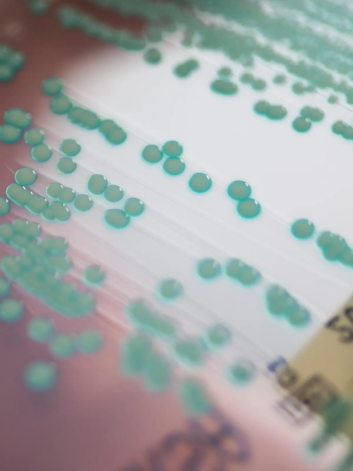 Eine Petrischale mit MRSA-Keimen (Methicillin-resistenten Staphylococcus aureus), aufgenommen am 10.04.2017 im Universitätsklinikum Regensburg (Bayern). Wulf Schneider ist Bayerns erster Professor für Krankenhaushygiene. Am Klinikum der Universität Regensburg bildet er Ärzte und medizinisches Fachpersonal weiter, berät Kliniken in Ostbayern und erforscht multiresistente Keime. (zu dpa «Keine Chance für Keime - erste Professur für Krankenhaushygiene» vom 19.05.2017) Foto: Armin Weigel/dpa +++ dpa-Bildfunk +++