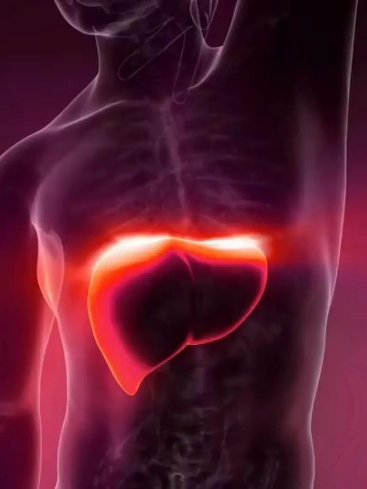 Bild zu: "Was passiert NACH der Fettleber? Darum solltet ihr bei der Diagnose schnell handeln "