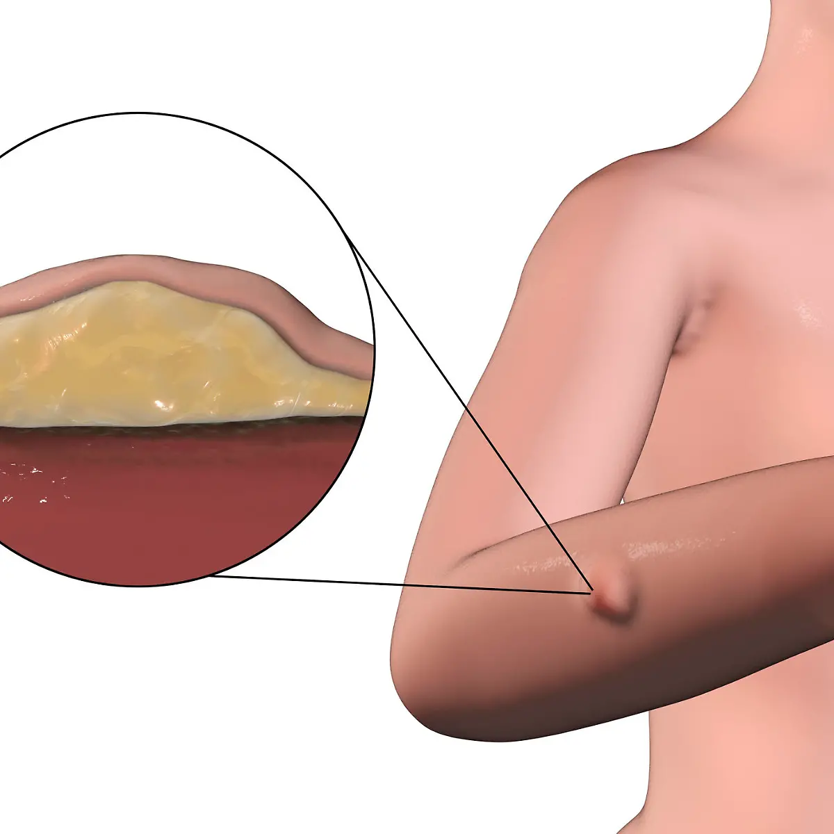 Lipom Logo von Lipom